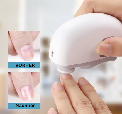 Nagelglanz® - Sanftschnitt Pro